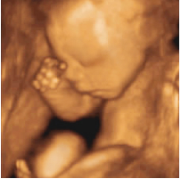 四維彩超什么時候做